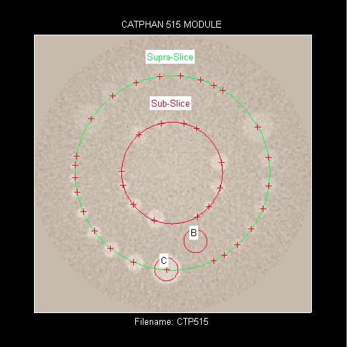Catphan 515 analyzed image