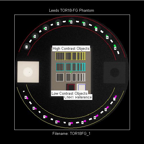 OBI and Leeds TOR18 analyzed image