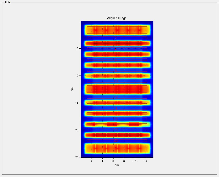 Varian dynamic MLC test 3 non-synchronized segmented stripes